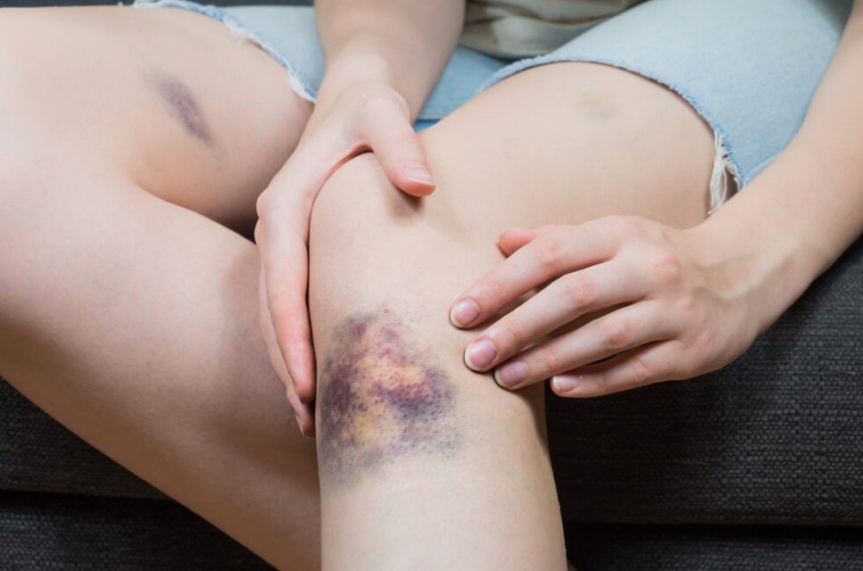 Chequeo de coagulación: TP, TTPa y fibrinógeno